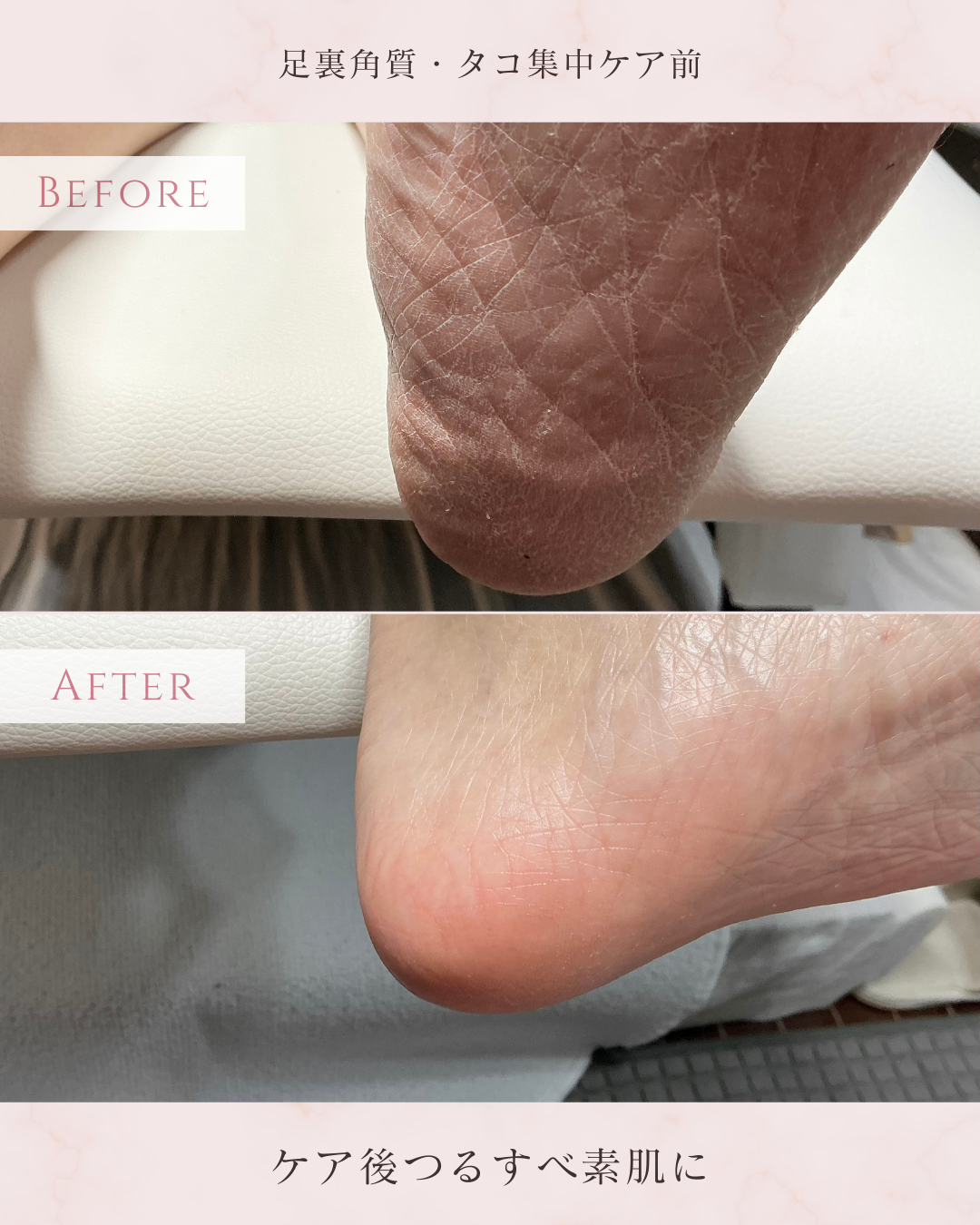 フットケアが得意なネイルサロンの写真